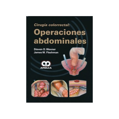 CIRUGIA COLORRECTAL. OPERACIONES ABDOMINALES