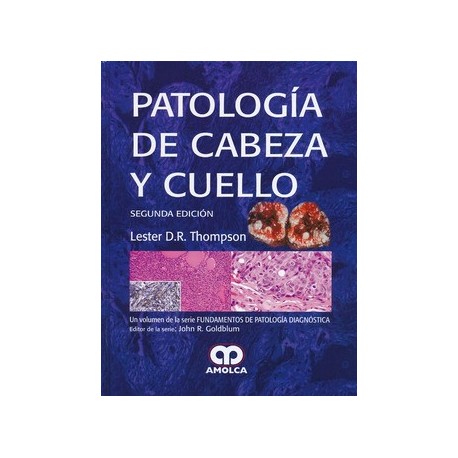PATOLOGIA DE CABEZA Y CUELLO