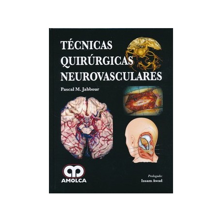 TECNICAS QUIRURGICAS NEUROVASCULARES