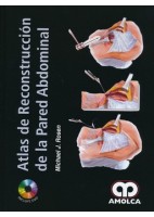 ATLAS DE RECONSTRUCCION DE LA PARED ABDOMINAL + DVD