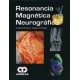 RESONANCIA MAGNETICA NEUROGRAFICA