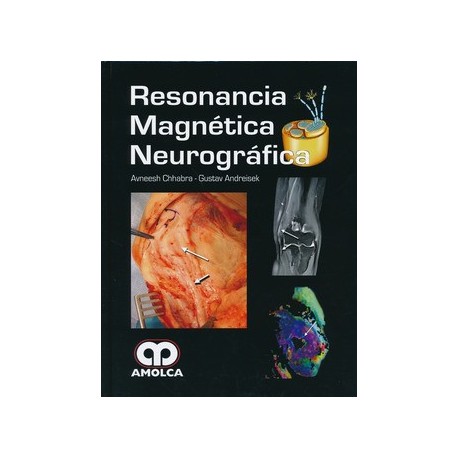 RESONANCIA MAGNETICA NEUROGRAFICA