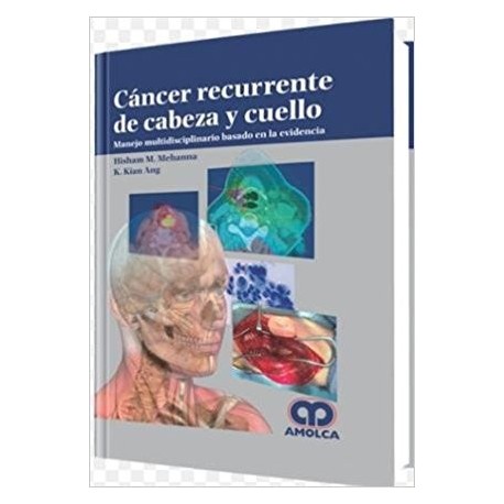 CANCER RECURRENTE DE CABEZA Y CUELLO. MANEJO MULTIDISCIPLINARIO BASADO EN LA EVIDENCIA