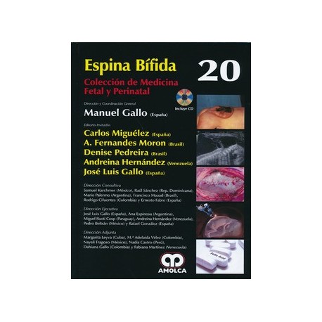 ESPINA BIFIDA + DVD (COLECCION DE MEDICINA FETAL Y PERINATAL, VOL. 20)