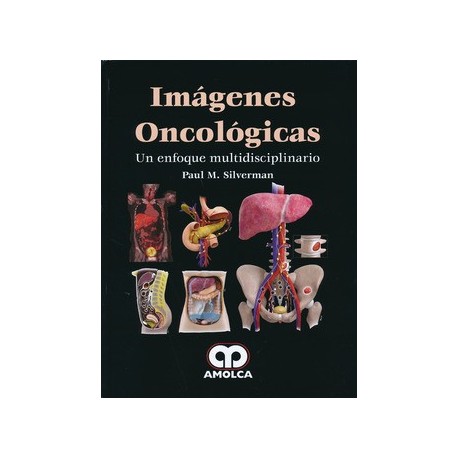 IMAGENES ONCOLOGICAS. UN ENFOQUE MULTIDISCIPLINARIO