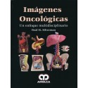 IMAGENES ONCOLOGICAS. UN ENFOQUE MULTIDISCIPLINARIO
