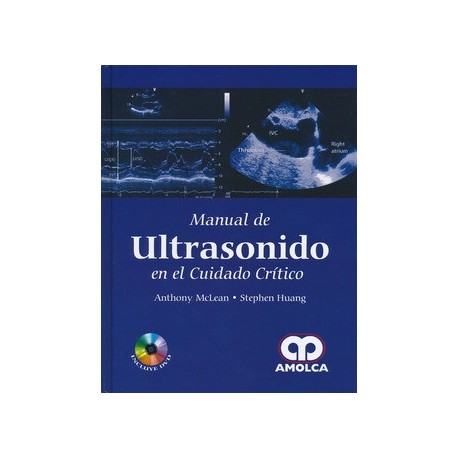 MANUAL DE ULTRASONIDO EN EL CUIDADO CRITICO (INCLUYE DVD)