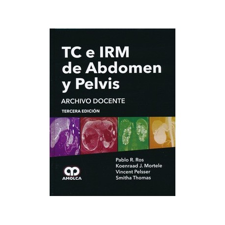 TC E IRM DE ABDOMEN Y PELVIS. ARCHIVO DOCENTE