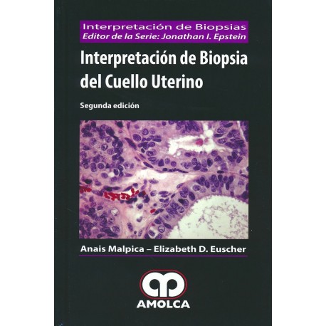 INTERPRETACION DE BIOPSIA DEL CUELLO UTERINO (INTERPRETACION DE BIOPSIAS)