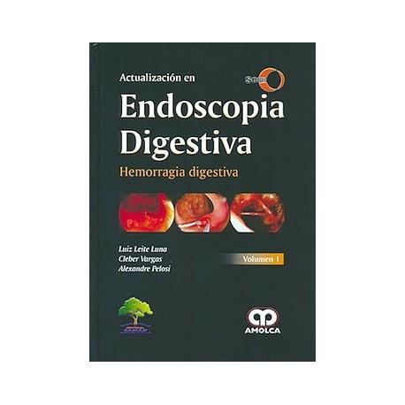 ACTUALIZACION EN ENDOSCOPIA DIGESTIVA VOL.1: HEMORRAGIA DIGESTIVA. SOBED