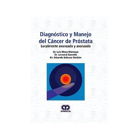 DIAGNOSTICO Y MANEJO DEL CANCER DE PROSTATA