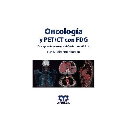 ONCOLOGIA Y PET/CT CON FDG