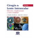 CIRUGIA DE LENTE INTRAOCULAR