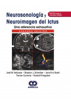 NEUROSONOLOGIA Y NEUROIMAGEN DEL ICTUS