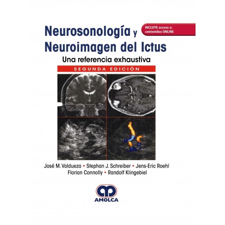 NEUROSONOLOGIA Y NEUROIMAGEN DEL ICTUS