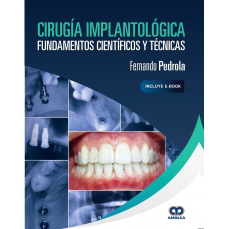 CIRUGIA IMPLANTOLOGICA. FUNDAMENTOS CIENTIFICOS Y TECNICAS (INCLUYE E-BOOK)