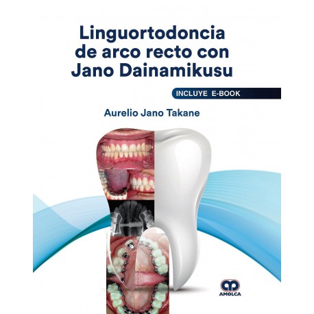 LINGUORTODONCIA DE ARCO RECTO CON JANO DAINAMIKUSU (INCLUTE E-BOOK)