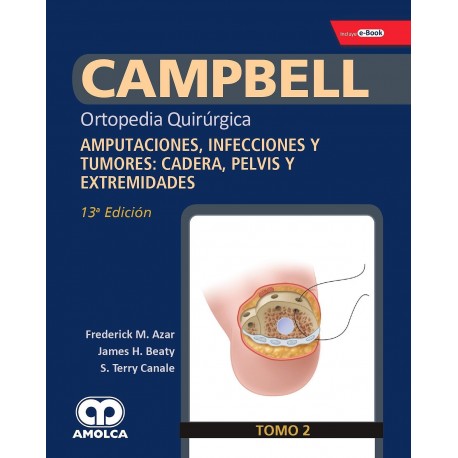 CAMPBELL ORTOPEDIA QUIRURGICA (TOMO 2) AMPUTACIONES, INFECCIONES Y TUMORES, CADERA, PELVIS Y EXTREMIDADES