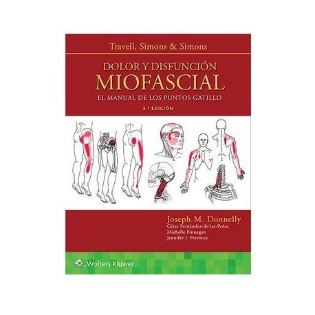 DOLOR Y DISFUNCION MIOFASCIAL. EL MANUAL DE LOS PUNTOS GATILLO