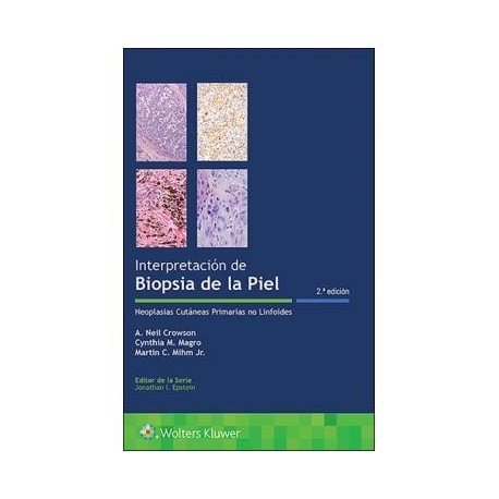 INTERPRETACION DE BIOPSIAS DE LA PIEL. NEOPLASIAS CUTANEAS PRIMARIAS NO LINFOIDES