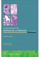 INTERPRETACION DE BIOPSIAS DE LA PROSTATA (INCLUYE EBOOK)