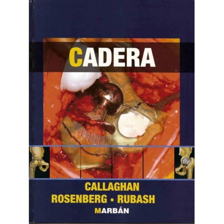 CADERA