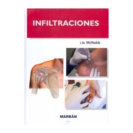INFILTRACIONES