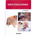 INFILTRACIONES