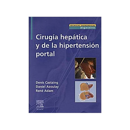 CIRUGIA HEPATICA Y DE LA HIPERTENSION PORTAL