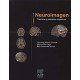 NEUROIMAGEN. TECNICAS Y PROCESOS COGNITIVOS