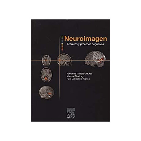 NEUROIMAGEN. TECNICAS Y PROCESOS COGNITIVOS