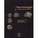 NEUROIMAGEN. TECNICAS Y PROCESOS COGNITIVOS