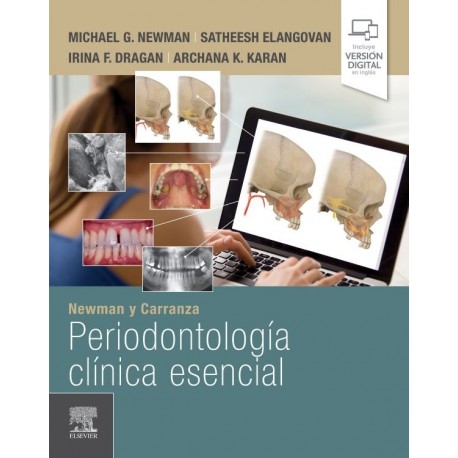 NEWMAN Y CARRANZA. PERIODONTOLOGIA CLINICA ESENCIAL (INCLUYE VERSION DIGITAL EN INGLES)