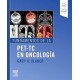 FUNDAMENTOS DE LA PET-TC EN ONCOLOGIA