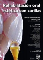 REHABILITACION ORAL ESTETICA CON CARILLAS
