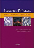 CANCER DE PROSTATA