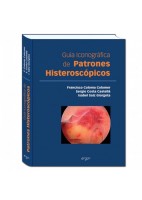 GUIA ICONOGRAFICA DE PATRONES HISTEROSCOPICOS
