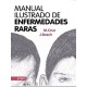 MANUAL ILUSTRADO DE ENFERMEDADES RARAS
