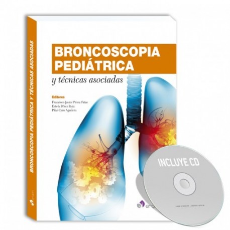 BRONCOSCOPIA PEDIATRICA Y TECNICAS ASOCIADAS