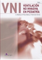 VENTILACION NO INVASIVA EN PEDIATRIA