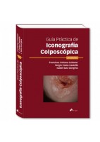 GUIA PRACTICA DE ICONOGRAFIA COLPOSCOPICA