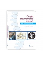 CIRUGIA MINIMAMENTE INVASIVA DE LA COLUMNA VERTEBRAL