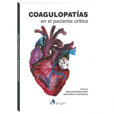 COAGULOPATIAS EN EL PACIENTE CRITICO