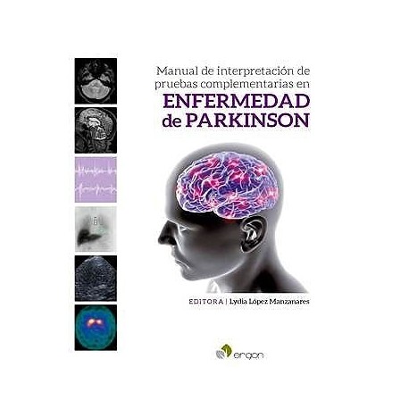 MANUAL DE INTERPRETACION DE PRUEBAS COMPLEMENTARIAS EN ENFERMEDAD DE PARKINSON