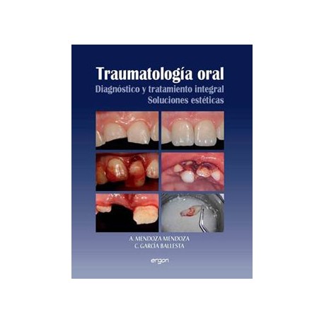 TRAUMATOLOGIA ORAL. DIAGNOSTICO Y TRATAMIENTO INTEGRAL. SOLUCIONES ESTETICAS