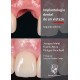 IMPLANTOLOGIA DENTAL DE UN VISTAZO