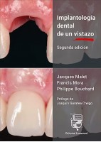 IMPLANTOLOGIA DENTAL DE UN VISTAZO
