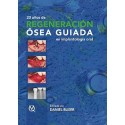 20 AÑOS DE REGENERACION OSEA GUIADA EN IMPLANTOLOGIA ORAL