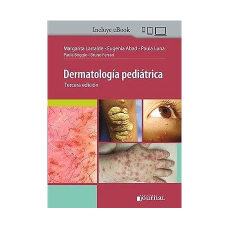 DERMATOLOGIA PEDIATRICA (INCLUYE E-BOOK)