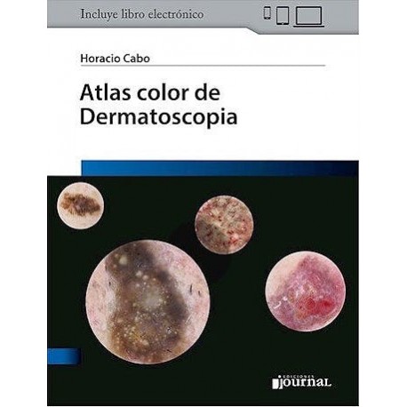 ATLAS COLOR DE DERMATOSCOPIA (LIBRO + EBOOK)
